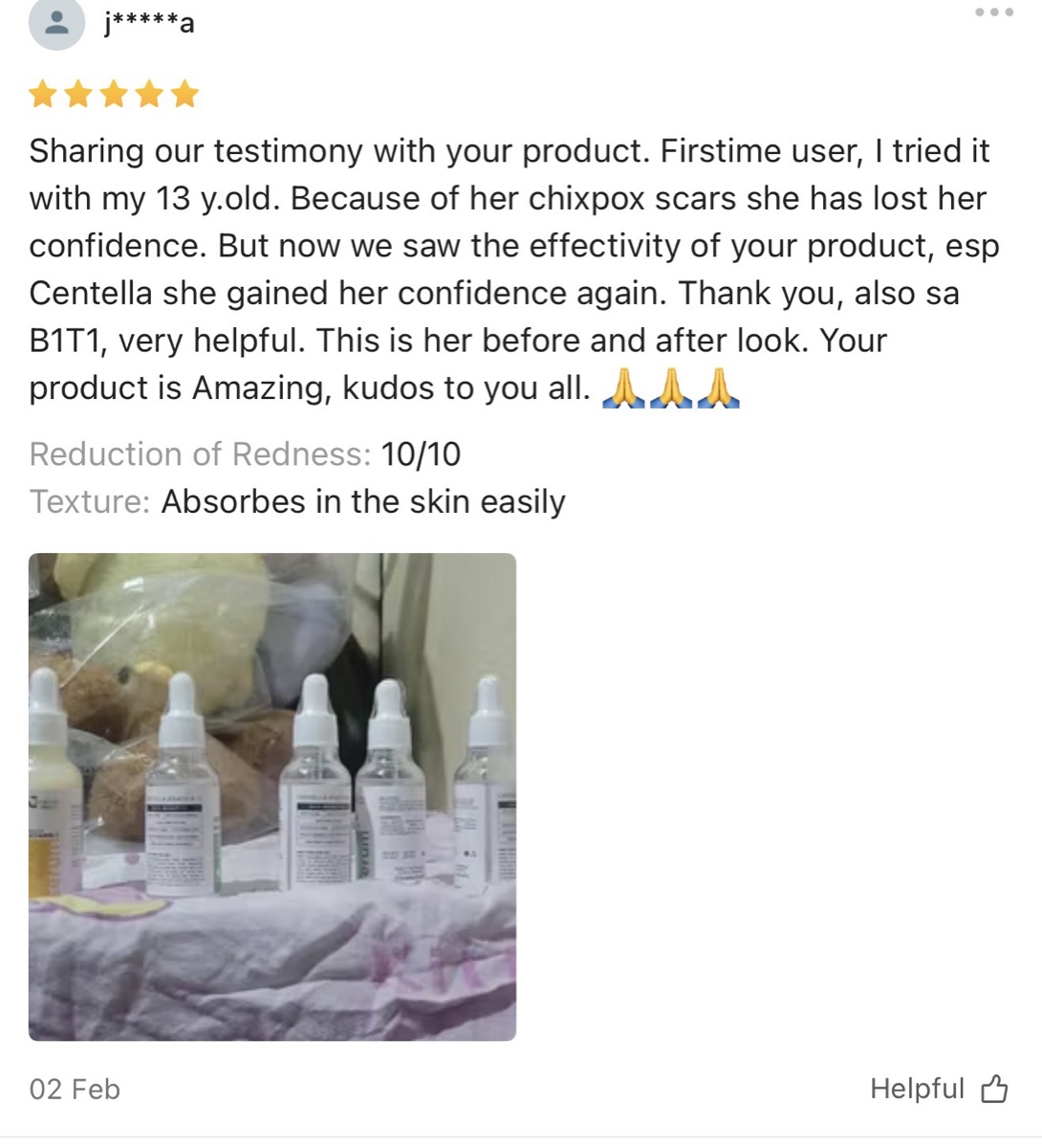 Five-star Shopee review: Centella helped a 13-year-old's chickenpox scars and restored her confidence, 10/10 redness reduction